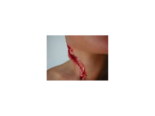 Plaie Hémorragique du Cou Plaie Hémorragique du Cou