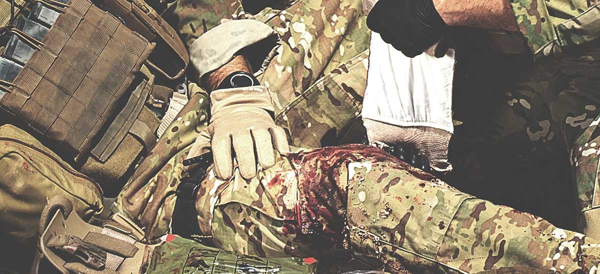 Massive Bleeding Control Massive Bleeding Control