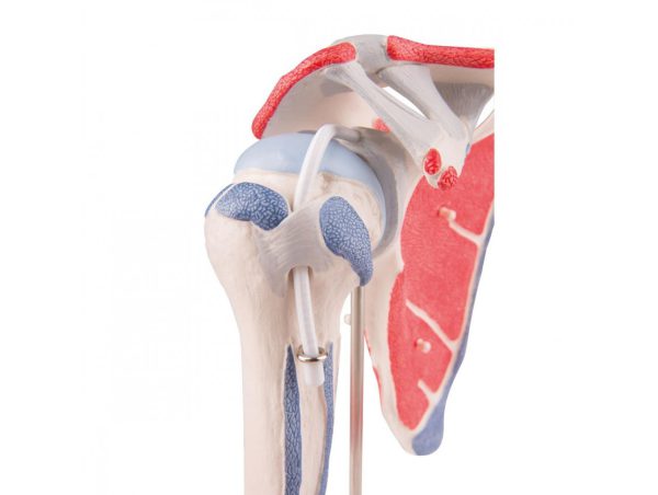 Epaule avec Coiffe des Rotateurs - 5 pièces Epaule avec Coiffe des Rotateurs - 5 pièces