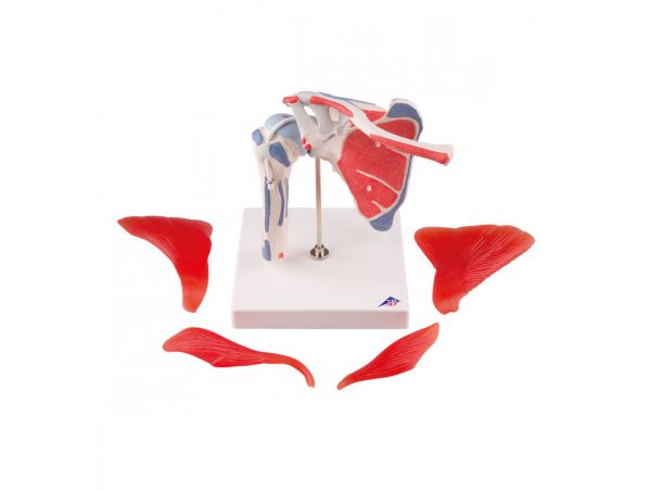 Epaule avec Coiffe des Rotateurs - 5 pièces Epaule avec Coiffe des Rotateurs - 5 pièces